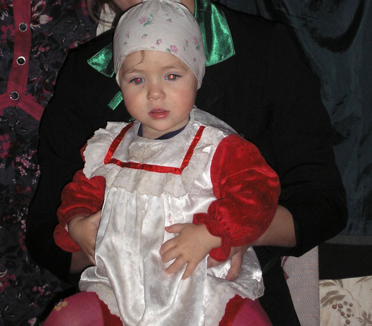 Orphan Mother with baby